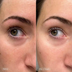 Brightening Under Eye Patches Set