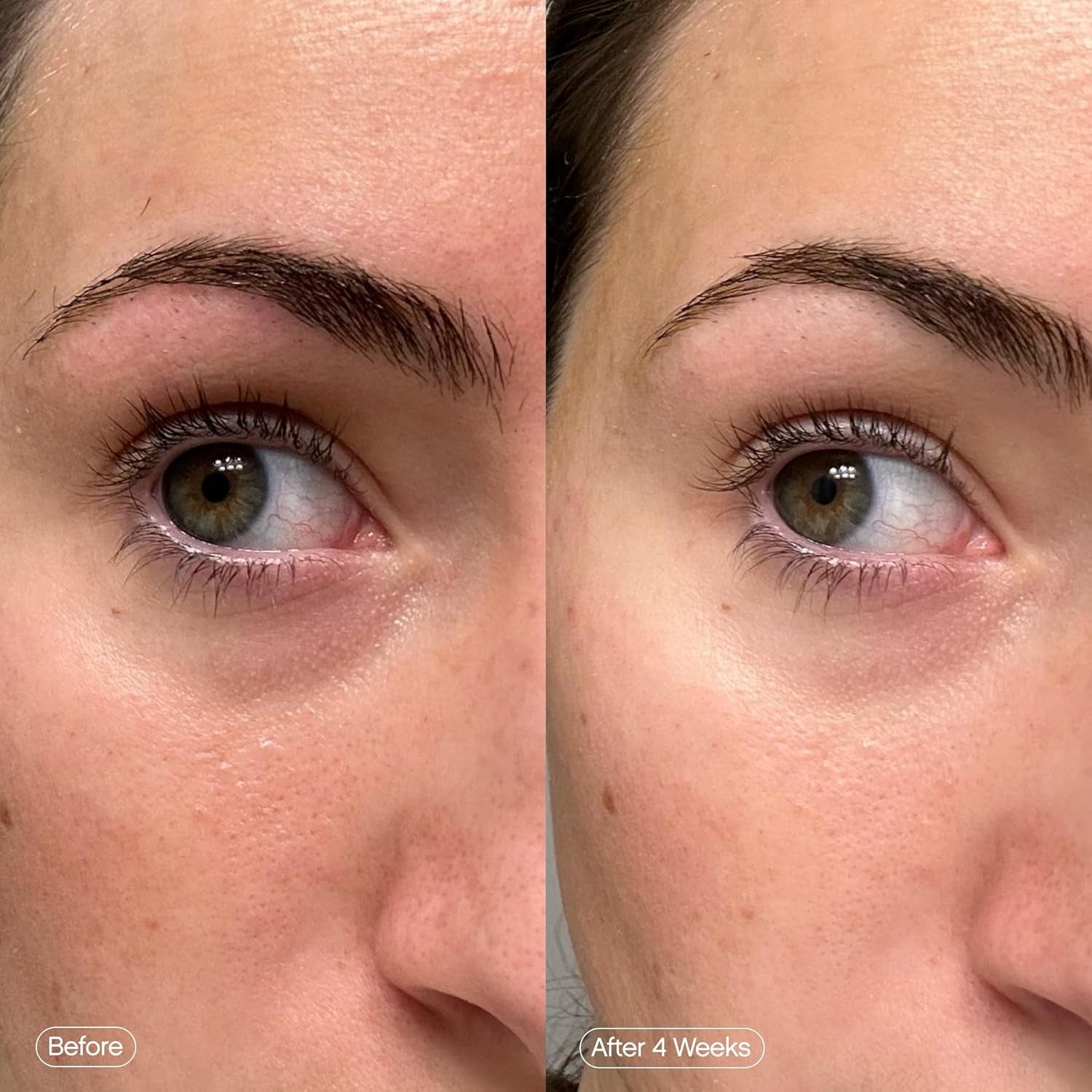 Brightening Under Eye Patches Set